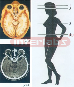 ANATOMICAL DISL MODEL OF FEMALE HUMAN TORSO Section 2